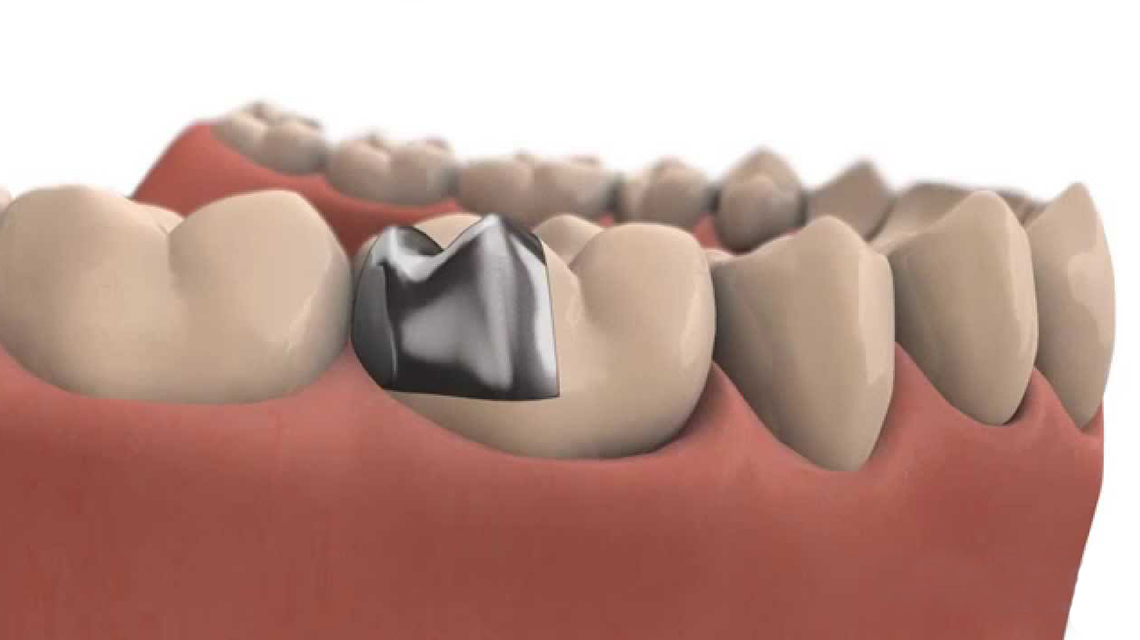 Dentalia smiles